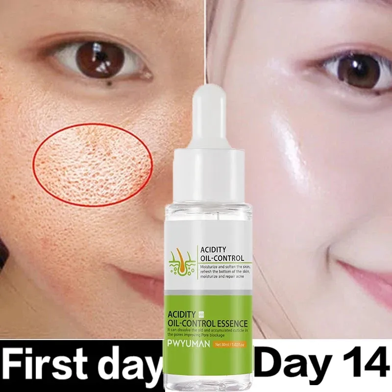 Lactic Acid Pore Shrink Face Serum Remove Blackheads Acne Oil Control Repair Gel Moisturizing Nourish Pores Firming Beauty Care