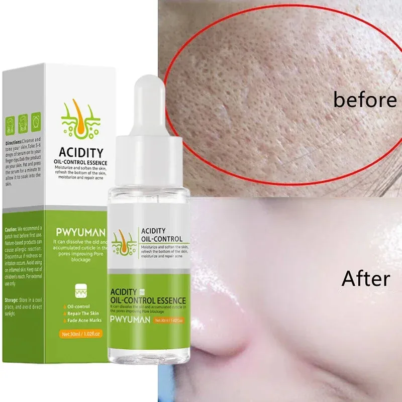 Lactic Acid Pore Shrink Face Serum Remove Blackheads Acne Oil Control Repair Gel Moisturizing Nourish Pores Firming Beauty Care