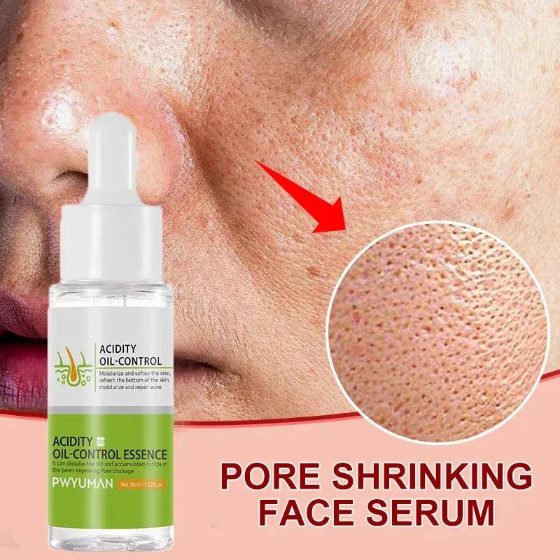 Lactic Acid Pore Shrink Face Serum Remove Blackheads Acne Oil Control Repair Gel Moisturizing Nourish Pores Firming Beauty Care