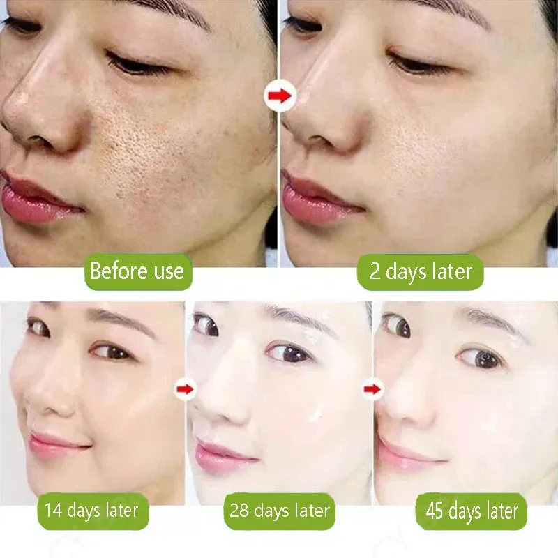 Lactic Acid Pore Shrink Face Serum Remove Blackheads Acne Oil Control Repair Gel Moisturizing Nourish Pores Firming Beauty Care